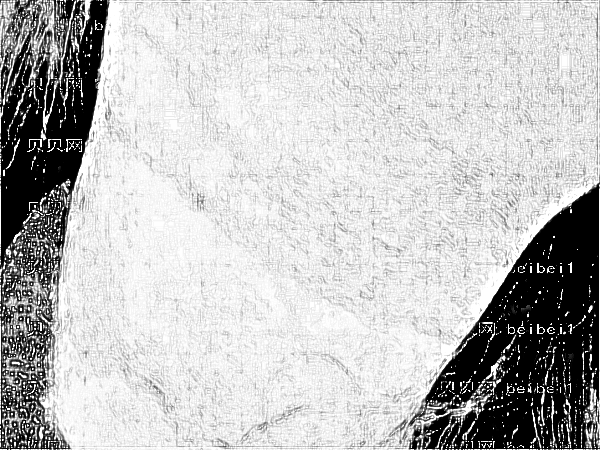 合肥禾丽西婵医疗热玛吉【、介绍】