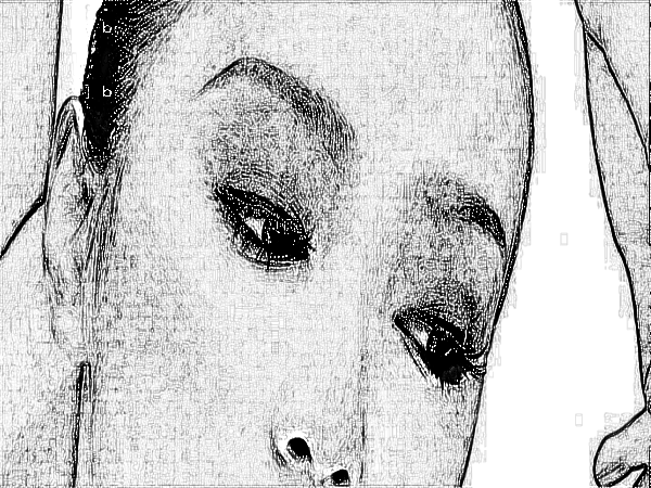 上海伯思立医疗美容热玛吉除皱好吗?果怎么样?