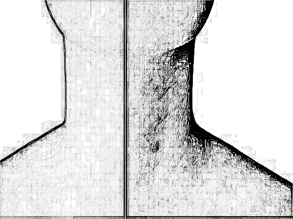合肥恒美整形医院热玛吉多少钱?怎么样?好不好?