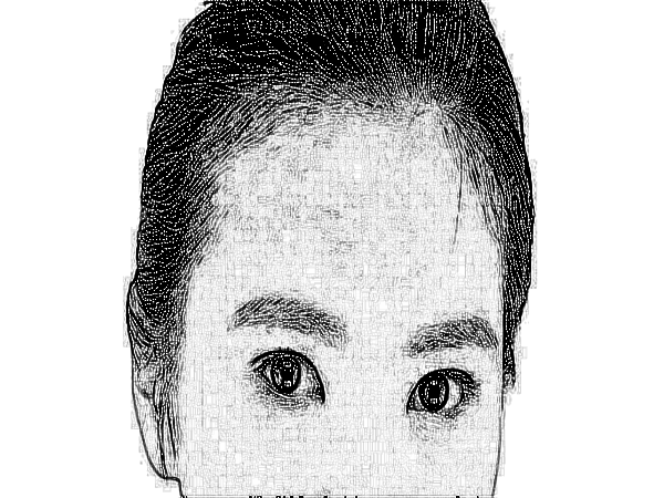 北京华韩整形医院热玛吉除皱怎么样?介绍体验分享