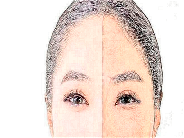 合肥艺星整形医院热玛吉哪个医生好?名单五位医生介绍和近期整形优惠价格