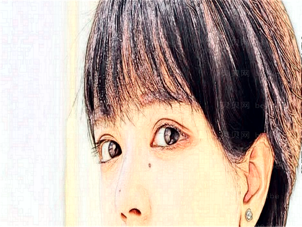 北京玉之光眼睛割双眼皮口碑怎么样?好不好?