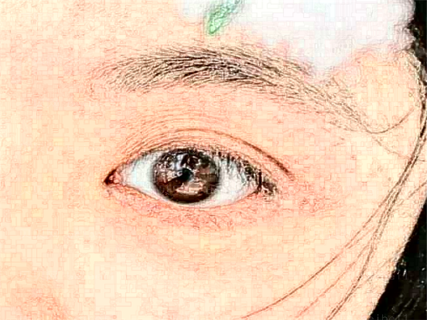 北京玉之光眼睛割双眼皮哪个医生好?果好吗?