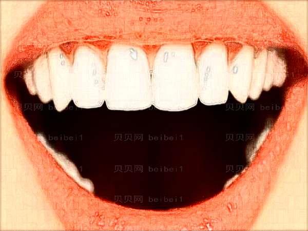 北京医院牙齿美白怎么样_整形分享