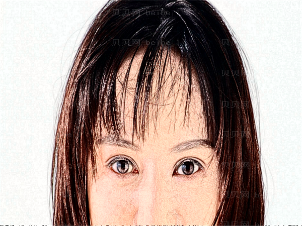福州爱美尔眼睛割双眼皮【、介绍】