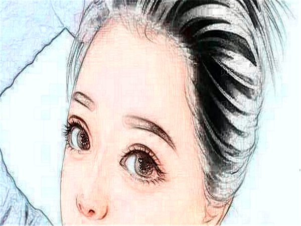 福州爱美尔眼睛割双眼皮为什么那么贵?大概能优惠多少钱?