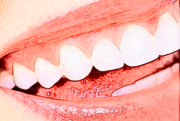 四川米兰柏羽牙齿修复的几种方法?牙齿修复的医生