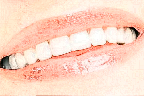 上海伊莱美牙齿美白哪种方法好?牙齿美白整形价格一览表