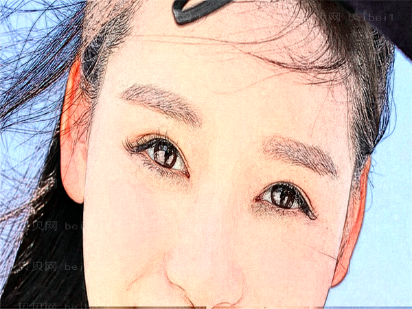 南阳三院眼睛割双眼皮技术怎么样?好吗?