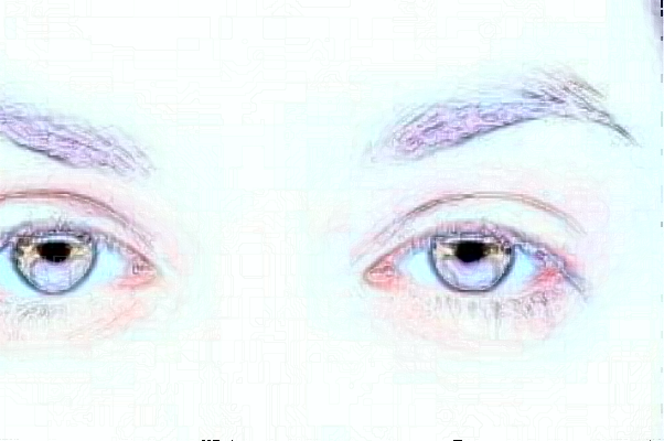 上海伊莱美切眉的好处与副作用?切眉后多久恢复自然