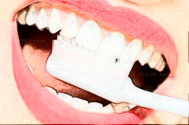 上海伊莱美牙齿美白的好办法?牙齿美白可以改良牙黄吗