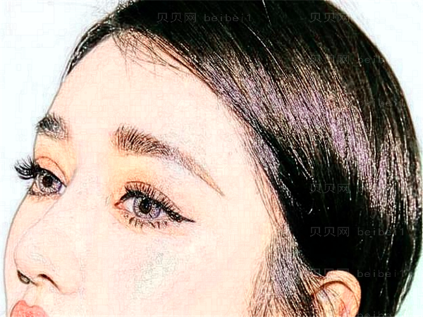 北京301整容医院眼睛割双眼皮多少钱?怎么样?好不好?