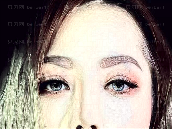 北京301整容医院眼睛割双眼皮怎么样?技术好吗?