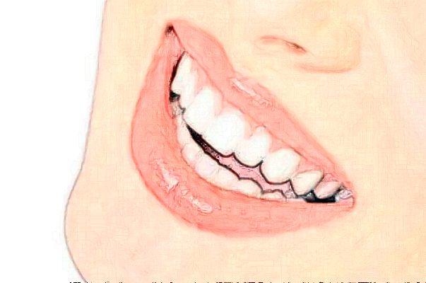 长沙美莱牙齿种植的过程痛吗?牙齿种植的危害?