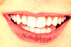 长沙美莱牙齿矫正挂什么科?牙齿矫正需要拔牙齿吗