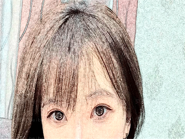 北京301整容医院眼睛割双眼皮好吗?