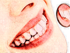 成都华西口腔医院做的牙齿矫正怎么样? 请享受术前术后的图