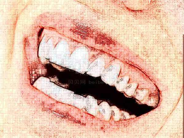 成都华西口腔医院牙齿矫正失败介绍多吗 要花多少钱?