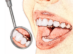 成都圣贝口腔牙齿矫正手术成都圣贝口腔,年牙齿矫正手术费用一览公开