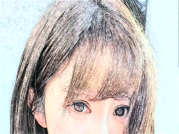 西安高一生全切双眼皮多少钱?价格公开!附介绍参考!