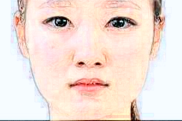南京华韩奇致下巴整形价格?下巴整形价格一览
