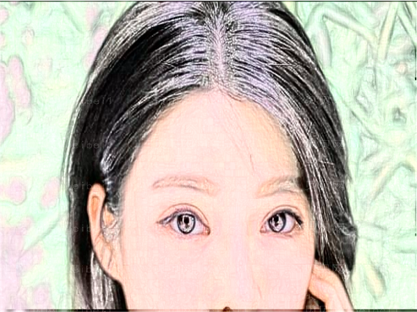 深圳港美双眼皮失败修复怎么样?好不好?多少钱?