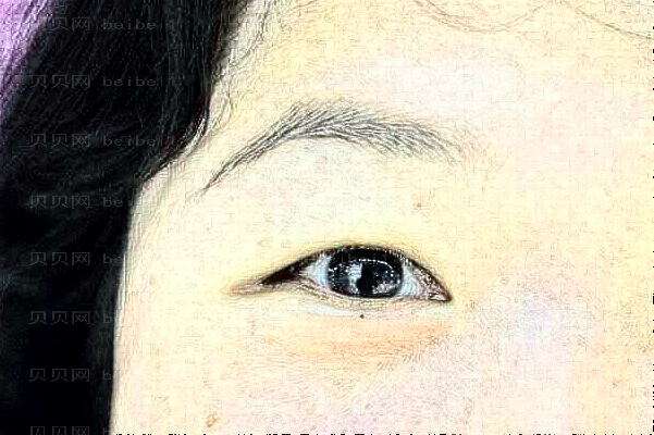 北京蒂凡妮开眼角整形价格一览?附介绍