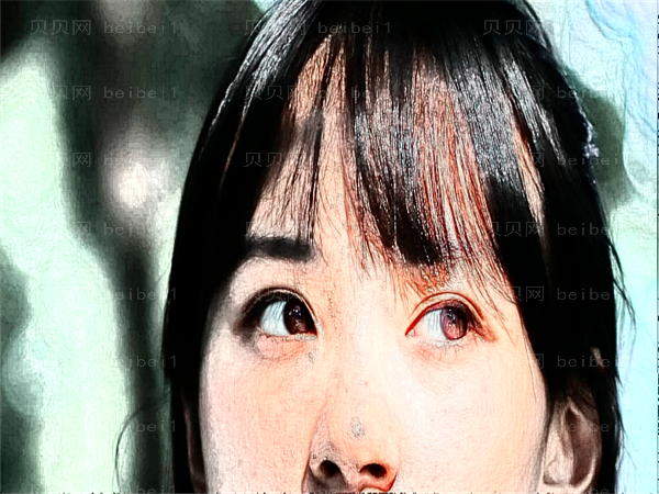 第四军医大学口腔医院全切割双眼皮一般多少钱？有价格吗？