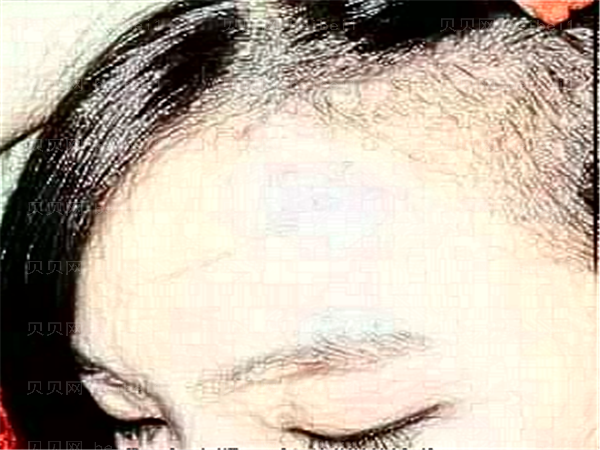 厦门思明海峡丰额头靠谱吗？附真实介绍分享
