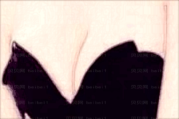 深圳阳光隆胸收费怎么样?哪个医生好