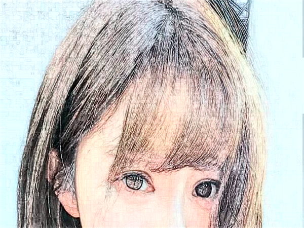 杭州美莱开眼角哪个医生做得好_附人气医生名单