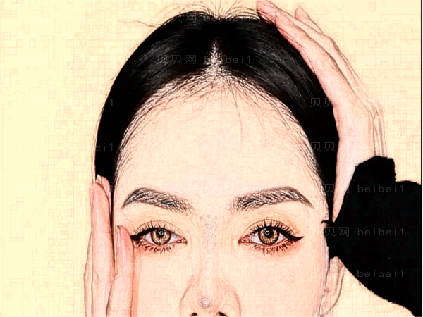杭州美莱开眼角做得好不好_附真实介绍展示