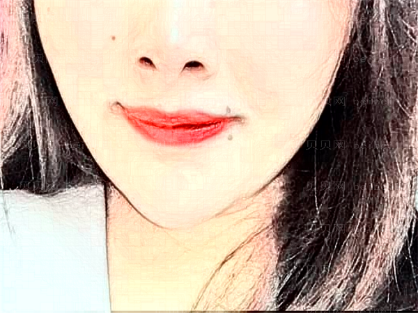 无锡坤如玛丽丰唇价格_丰唇能维持多久