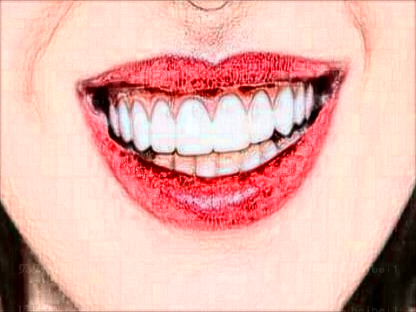 扬州贝恩口腔牙齿种植介绍过程分享_收费标准公布