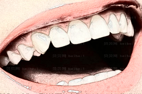 扬州贝恩口腔牙齿种植介绍过程分享_收费标准公布
