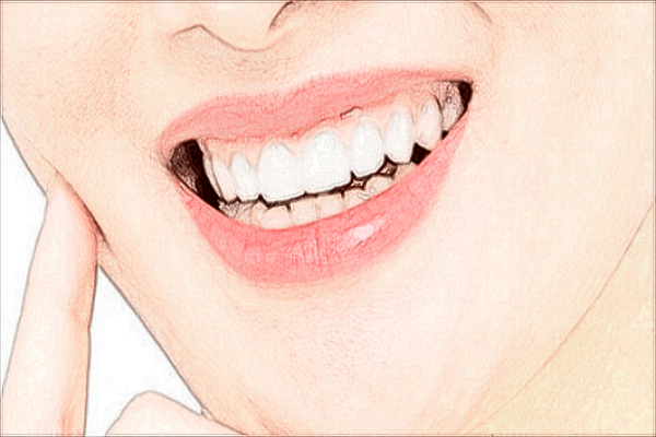 辽宁曙光牙齿修复有什么办法?哪个医生做得好?