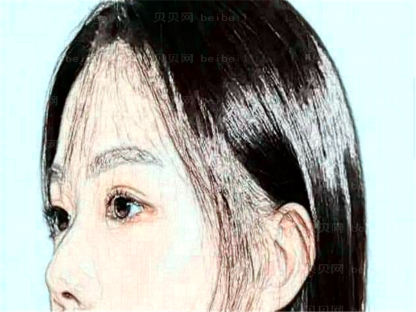 四川华美紫馨做埋线提升做得好不好_收费高不高