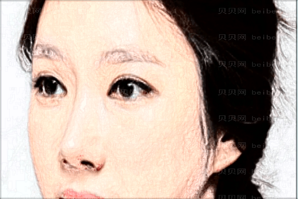 杭州格莱美隆鼻整形价格一览发布!医生排名名单