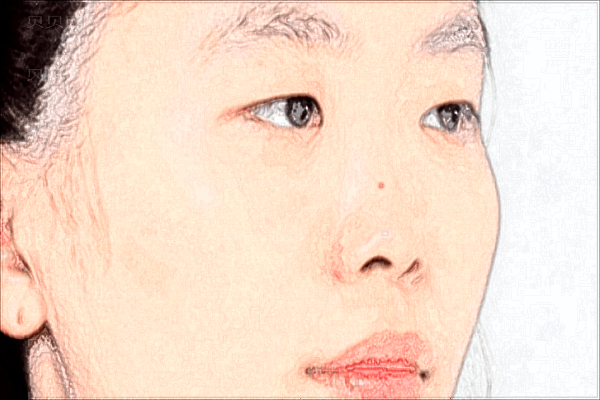 重庆美仑美奂隆鼻整形价格一览|附介绍分享