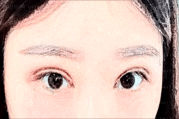东莞西妃眼修复哪个医生好?眼修复时间要多少