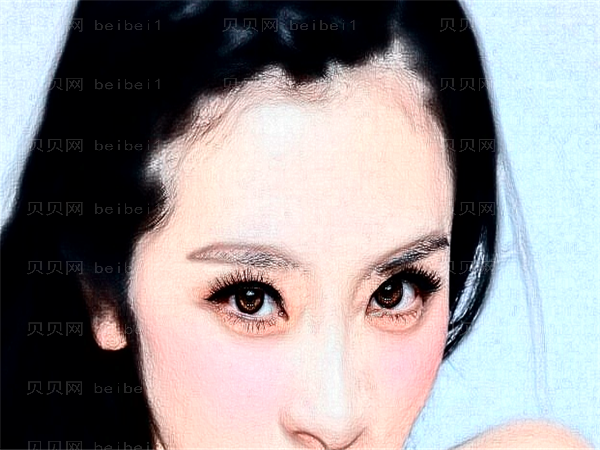 合肥东方怡人做双眼皮贵不贵_2022全新价格一览