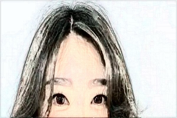 深圳阳光毛发种植价格贵不贵_价格一览