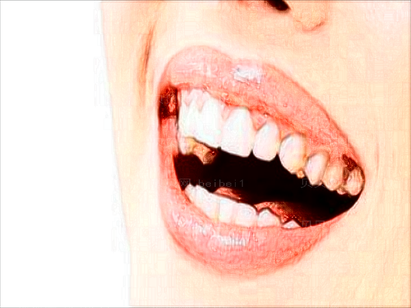 宁波恒美口腔门诊部根管调节价格多少?整牙过程分享