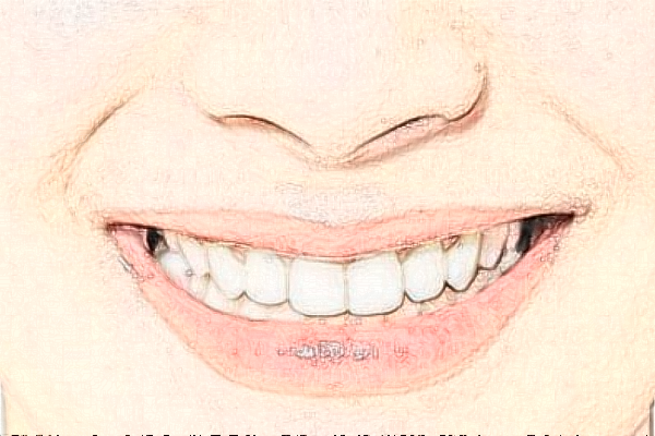 青岛牙博士口腔门诊部全口种植医生那个好?附介绍分享