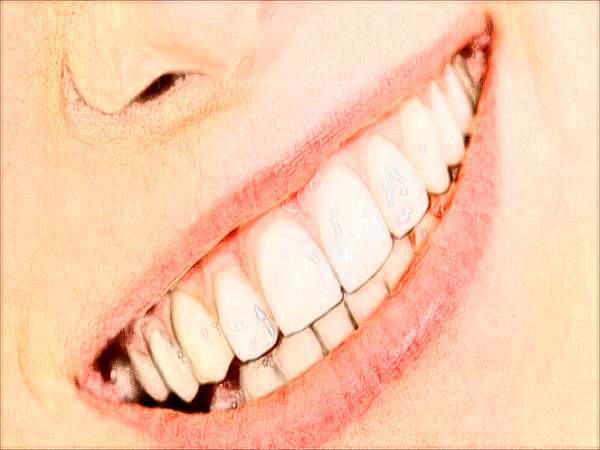 2022泸州牙博士口腔诊所牙齿修复多少钱_做的好不好