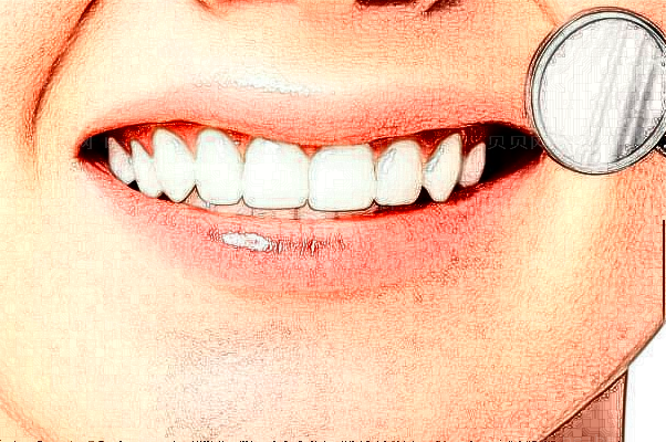 衡阳优伢仕口腔牙齿矫正好的医生有哪些?医生名单