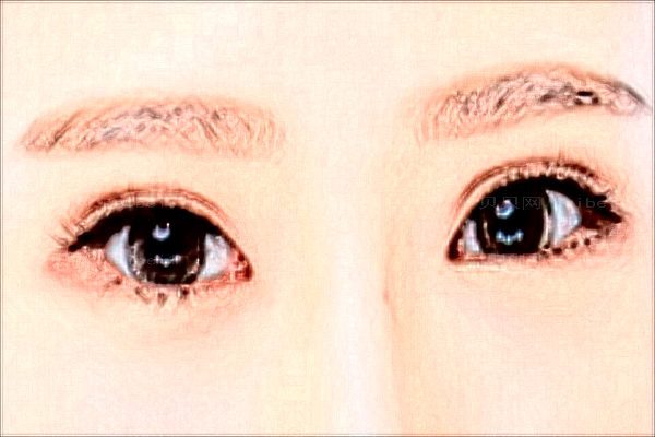 成都西区开眼角怎么样?医生排名介绍