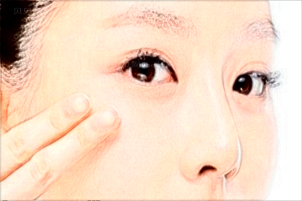 扬州市邗江施尔美开眼角做得怎么样_开眼角会留疤吗?