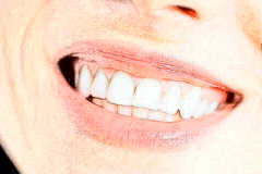 淮安诺贝尔口腔牙齿修复好的医生有哪些?医生名单