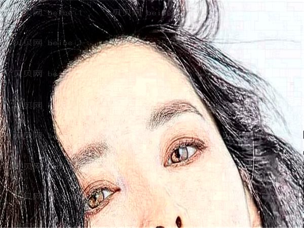 南关区久诺美开眼角做得好不好